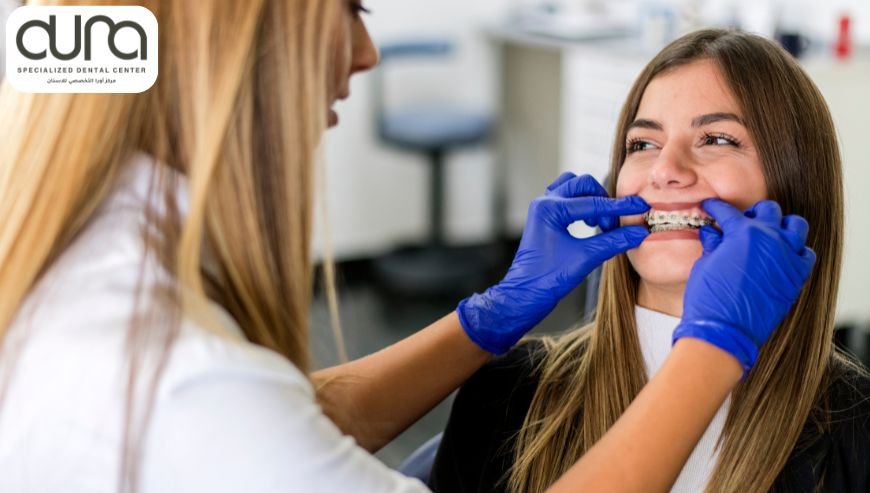 Orthodontic Services at Aura Specialized Dental Center