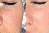 Skincare at Fawz Beauty Radiance You Deserve!Salon