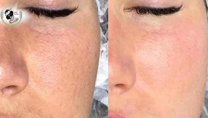 Skincare at Fawz Beauty Radiance You Deserve!Salon