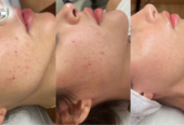 Skincare at Fawz Beauty Radiance You Deserve!Salon