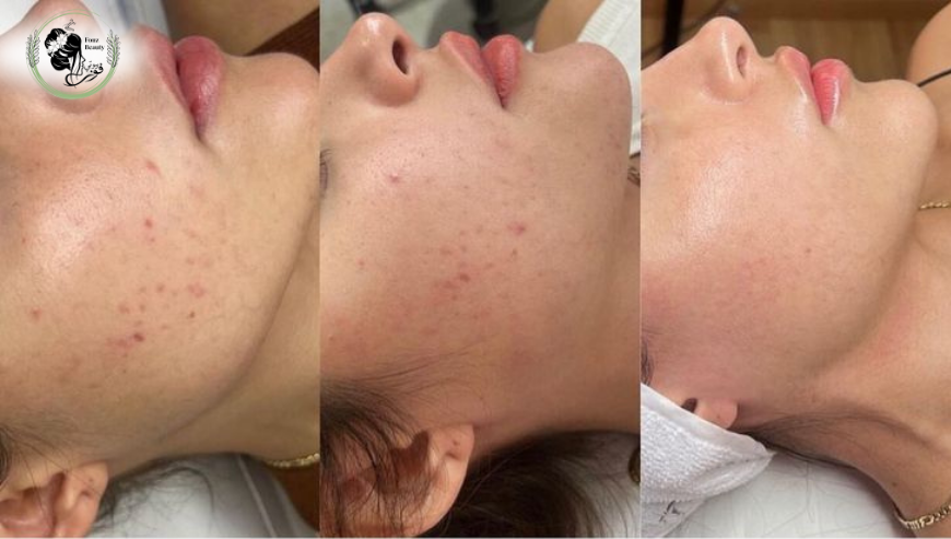 Skincare at Fawz Beauty Radiance You Deserve!Salon
