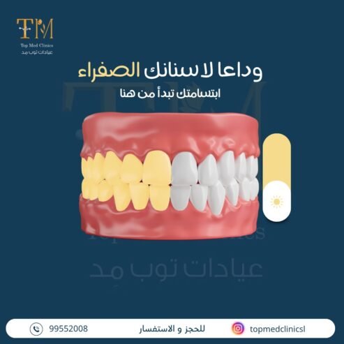 Say Goodbye to Yellow Teeth top med clinics
