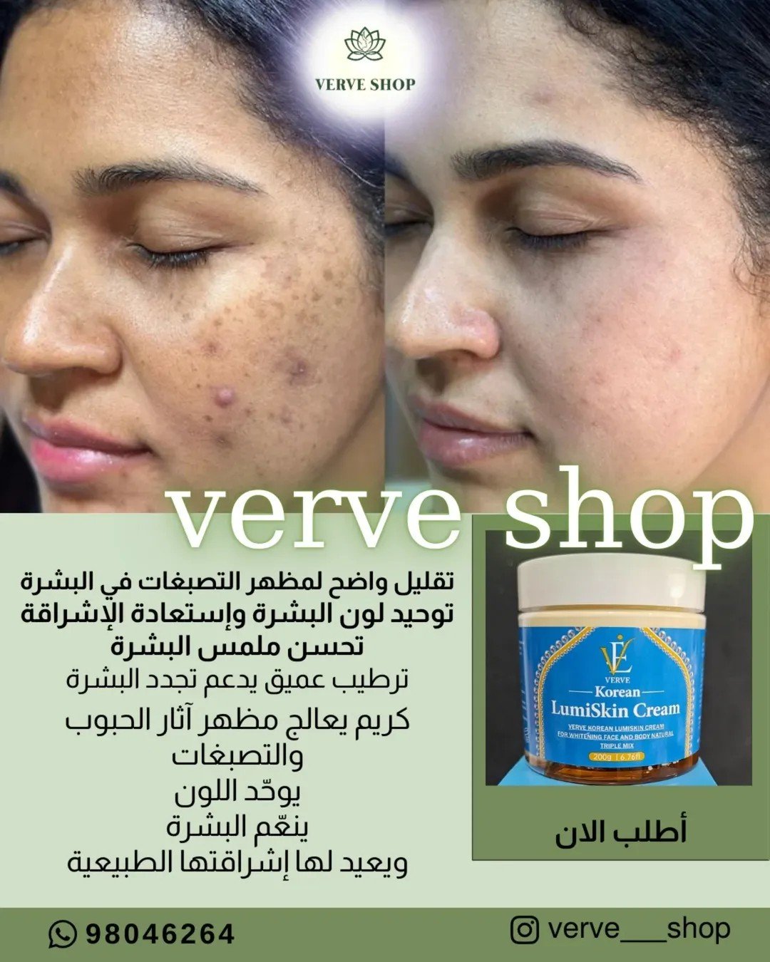 هل-تعانين-من-آثار-الحبوب،-التصبغات،-أو-بهتان-البشرة؟كريم-LumiSkin-Korean-من-Verve-Shop-هو-الحل-